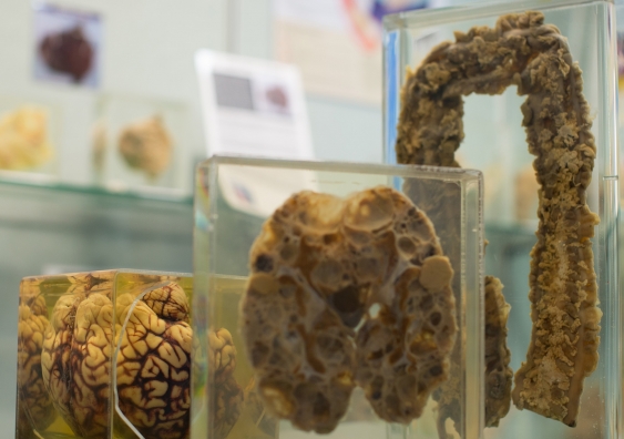 close up of specimens at the museum