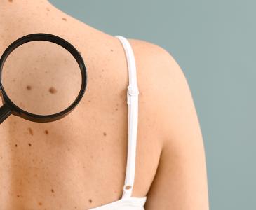 Skin check